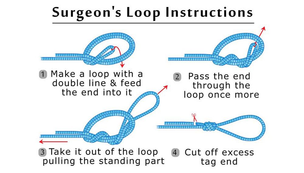Double Surgeon’s Loop
